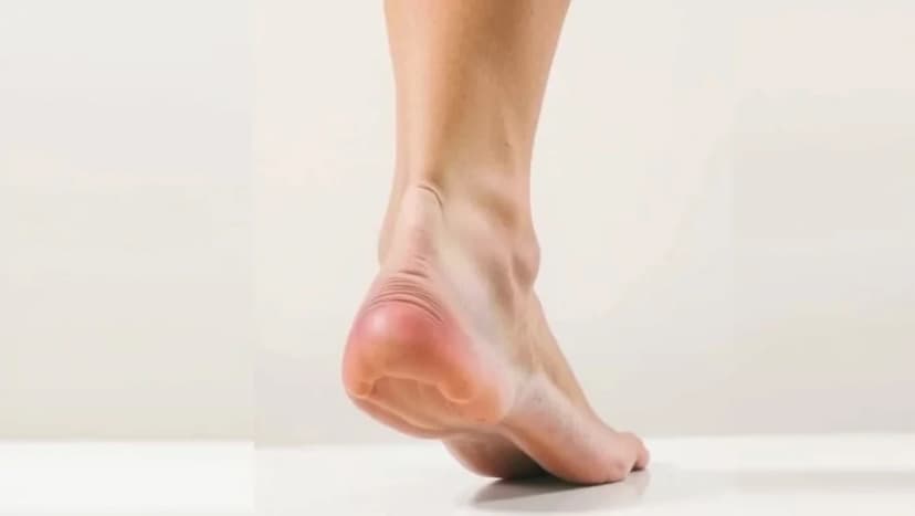 Hur vet man om hälsenan har gått av